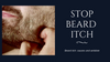 Beard Itch: Causes and Antidote